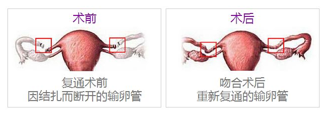 重慶送子鳥醫院